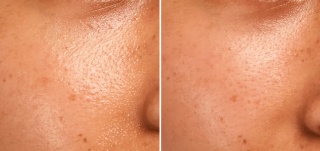 Primer Insta Matte para Pele Oleosa